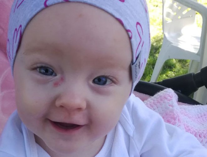 Lauruška potrebuje náročnú starostlivosť