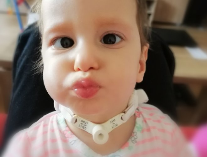 Ninkin vývoj už v brušku naznačoval, že bude po narodení čeliť viacerým komplikáciám