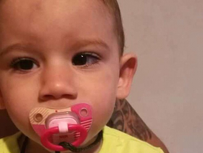 Fotka malého Jakubka, ktorému Lidl pomohol v rámci projektu Od začiatku v dobrých rukách