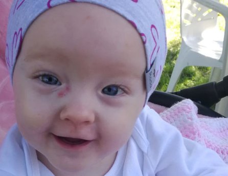 Lauruška potrebuje náročnú starostlivosť